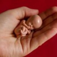 Karantīnas laikā pasaulē veikti vairāk nekā 10 miljoni abortu