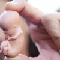 Tenesijas štatā apstiprina gandrīz pilnīgu abortu aizliegumu